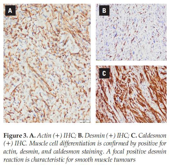 cistanche supplement